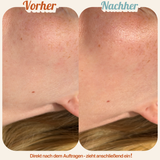 YouGlow 50+ FACE