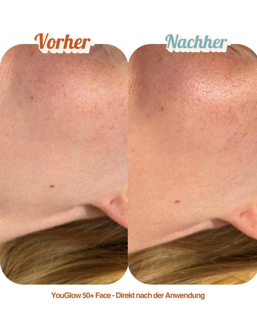 Probier Set - Full Glow & Care+ Set